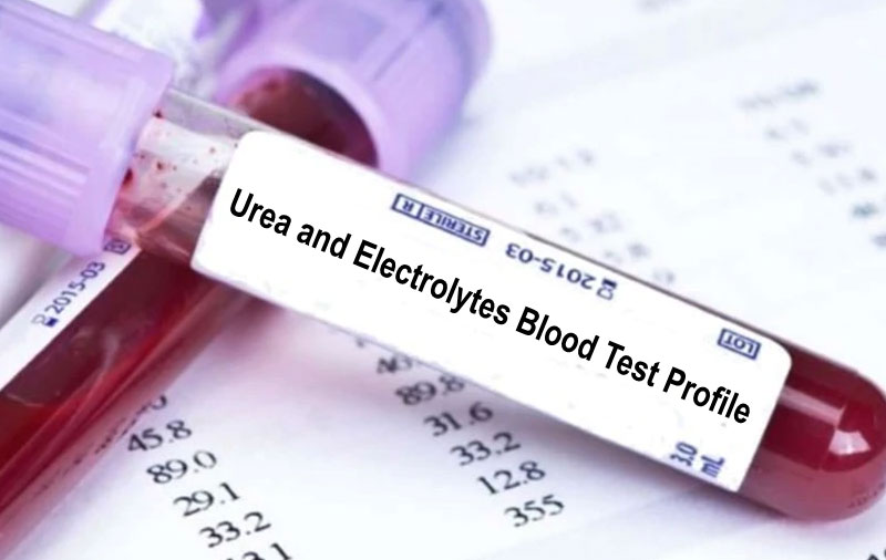 xét nghiệm ure máu