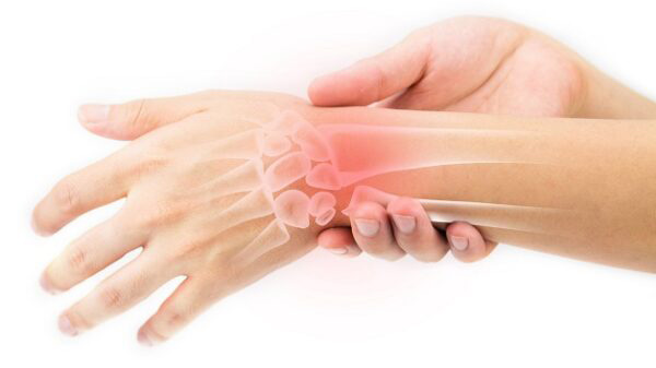 tay sưng và ngứa do hội chứng ống cổ tay