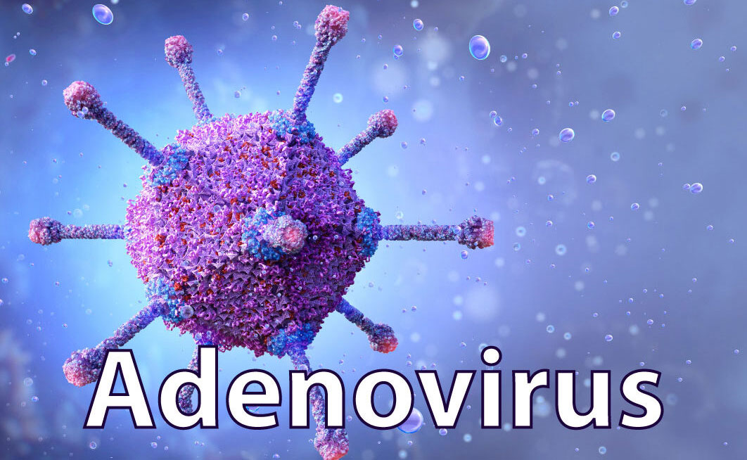 adenovirus triệu chứng và cách điều trị